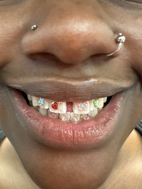 Close-up of a scattered set of colorful tooth gems, including a red heart, across the upper teeth