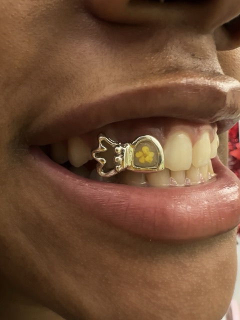 Close-up of a gold crown-and-heart tooth charm with a yellow flower inlay on an upper tooth